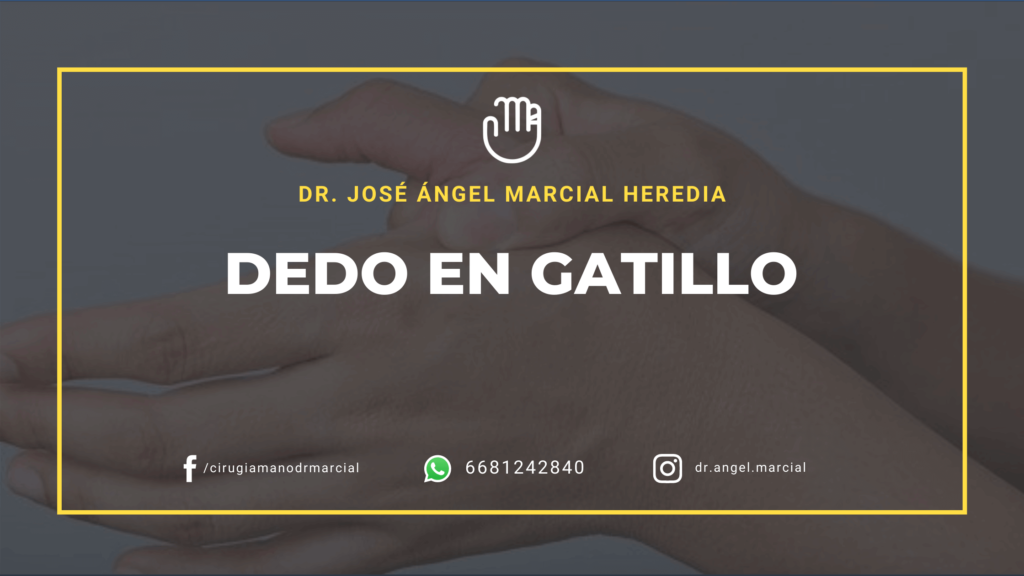 Dedo en Gatillo en Los Mochis Sinaloa