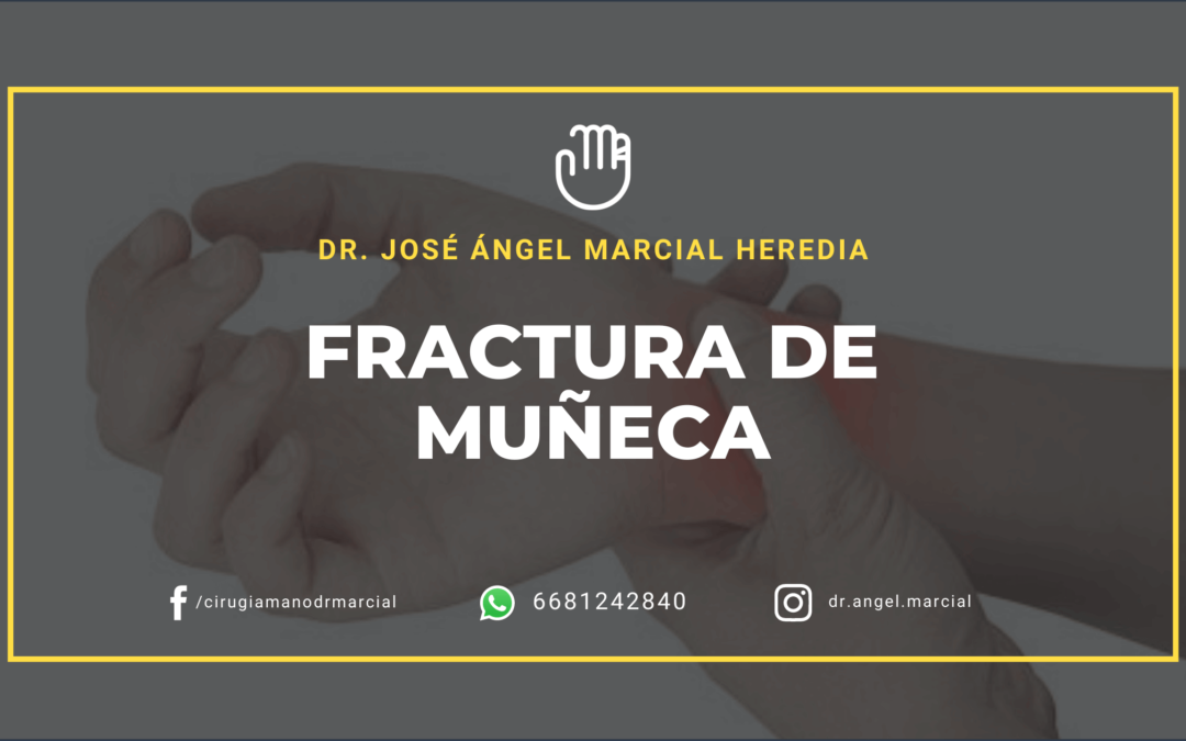 Fractura de muñeca