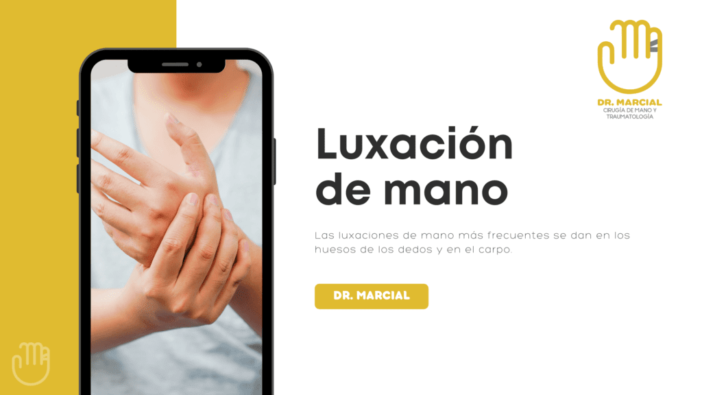 Luxación de mano